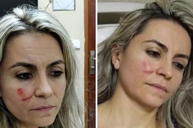 Şanlıurfa'da doktorun hasta tarafından darp edildiği iddia edildi
