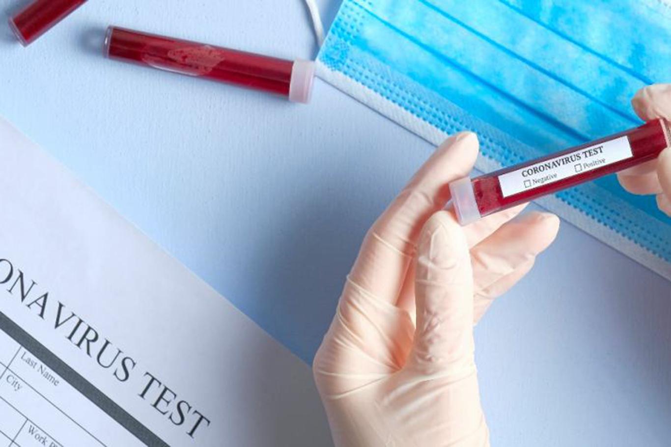 Corona salgınında ölü sayısı 21'e yükseldi