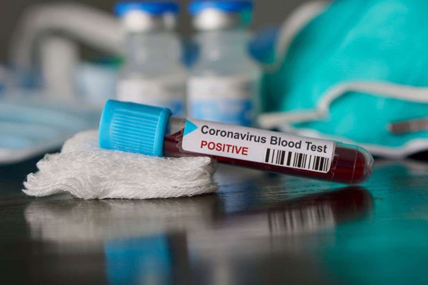 Coronavirus'ten 190 can kaybı yaşandı