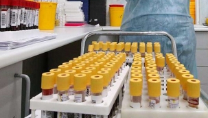 Coronavirus'ten 279 kişi hayatını kaybetti, 62 bin 797 yeni vaka tespit edildi