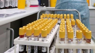 7 Kasım 2021 Coronavirus bilançosu