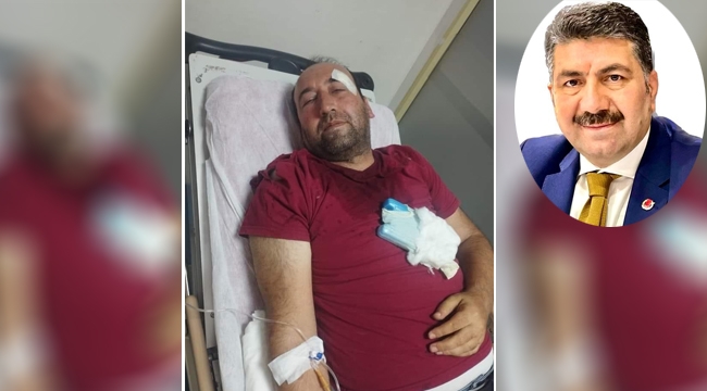 Viranşehir'de gazeteci darp edildi
